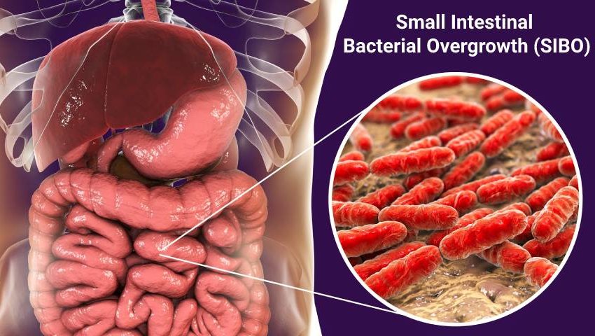 Small Intestinal Bacterial Overgrowth (SIBO)