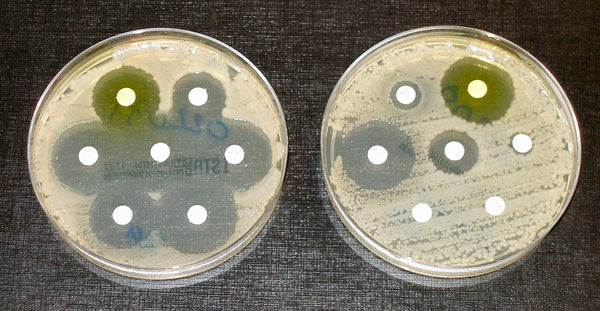 Flus Resistance to some drugs causes concern