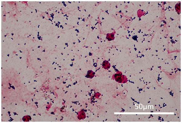 Allimed & Mrsa-Case Studies with Photos