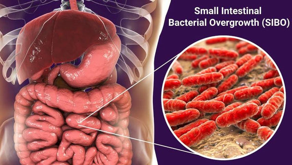 Small Intestinal Bacterial Overgrowth (SIBO)